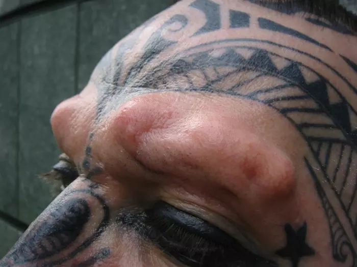 Crazy body modifications - horns